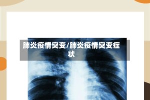 肺炎疫情突变/肺炎疫情突变症状