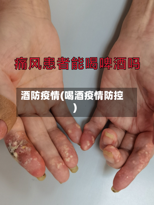 酒防疫情(喝酒疫情防控)-第2张图片